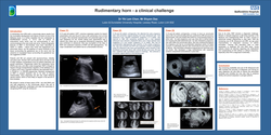 Thumbnail for Rudimentary horn - a clinical challenge