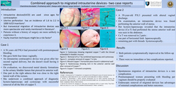 Thumbnail for Combined approach to migrated intrauterine devices- two case reports