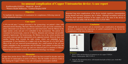 Preview of An unusual complication of Copper T-intrauterine device: A case report