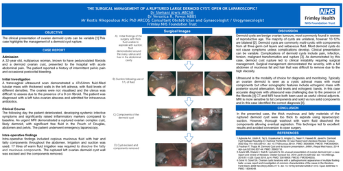 Preview of The surgical management of ruptured large dermoid cyst: Open or Laparoscopic.