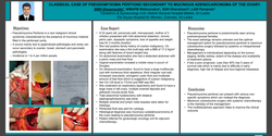 Thumbnail for CLASSICAL CASE OF PSEUDOMYXOMA PERITONEI SECONDARY TO MUCINOUS ADENOCARCINOMA OF THE OVARY.