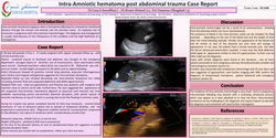 Thumbnail for intra-Amniotic hematoma post abdominal trauma Case Report