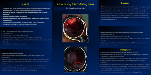 Preview of Case of cervical tuberculosis presenting as growth