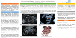 Thumbnail for Thoraco-omphalopagus Conjoined Twins: A Rare Case Report