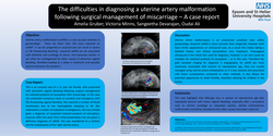 Thumbnail for The difficulties in diagnosing a uterine artery malformation