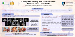 Thumbnail for A Body Stalk Anomaly with Accreta Placenta Spectrum Case: A Rare Entity
