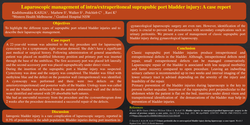 Thumbnail for Laparoscopic management of intra/extraperitoneal suprapubic port bladder injury: A case report