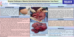 Thumbnail for Surgical Challenges of Massive Cervical and Uterine leiomyomas: Case Report