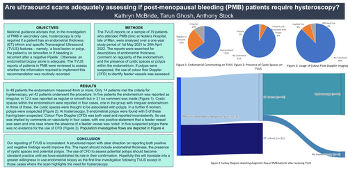 Preview of Are ultrasound scans adequately assessing if post-menopausal bleeding (PMB) patients require hysteroscopy?