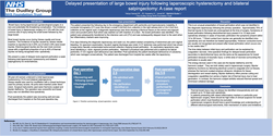 Thumbnail for Delayed presentation of large bowel injury following laparoscopic hysterectomy and bilateral salpingectomy