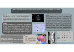 Thumbnail for ATYPICAL SYMPLASTIC LEIOMYOMA, UNUSUAL HISTOPATHOLOGICAL VARIANT OF LEIOMYOMA - CASE REPORT