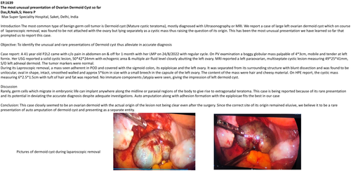 Preview of The most unusual presentation of Ovarian Dermoid Cyst so far