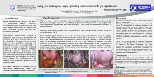 Preview of Dying from Rectovaginal Deeply Infiltrating Endometriosis? – the answer: DIE-NO-gest!