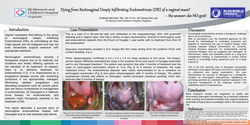 Thumbnail for Dying from Rectovaginal Deeply Infiltrating Endometriosis? – the answer: DIE-NO-gest!