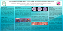 Thumbnail for Uncertainties with Tuboovarian Masses: Fallopian Tube Cancer in 2 Reproductive Aged Women