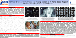 Thumbnail for Antley Bixler Syndrome in Young Women : A Rare Case Report