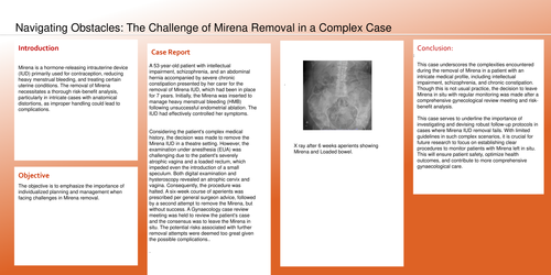 Preview of Navigating Obstacles: The Challenge of Mirena Removal in a Complex Case