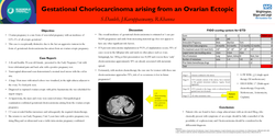 Thumbnail for Gestational Choriocarcinoma arising from an Ovarian Ectopic