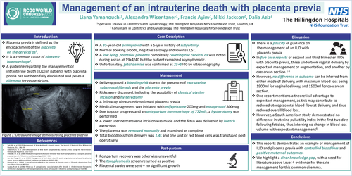 Preview of Management of intrauterine death with placenta previa