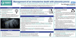 Thumbnail for Management of intrauterine death with placenta previa