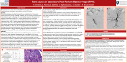 Thumbnail for Rare causes of secondary Post-Partum Hemorrhage (PPH).