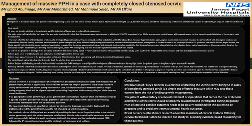 Preview of Management of massive PPH in a case with completely closed stenosed cervix.