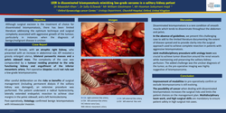 Thumbnail for LEER in disseminated leiomyomatosis mimicking low-grade sarcoma in a solitary kidney patient
