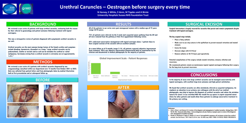 Preview of Urethral caruncles – oestrogen before surgery every time