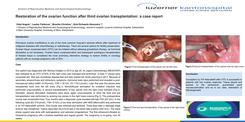 Preview of Restoration of the ovarian function after third ovarian transplantation: a case report
