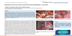 Thumbnail for Restoration of the ovarian function after third ovarian transplantation: a case report