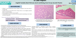 Thumbnail for Uterine tumour resembling ovarian sex-cord tumour: a case report