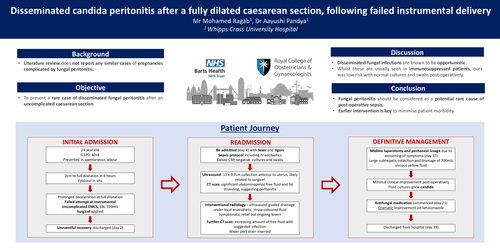 Preview of Disseminated candidal peritonitis complicating a fully dilated caesarean section.