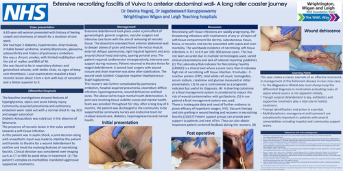 Preview of Extensive Necrotizing Fasciitis from Vulva to Umbilicus – A long roller coaster journey