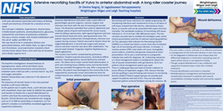 Thumbnail for Extensive Necrotizing Fasciitis from Vulva to Umbilicus – A long roller coaster journey