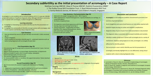 Preview of Secondary subfertility as the initial presentation of acromegaly