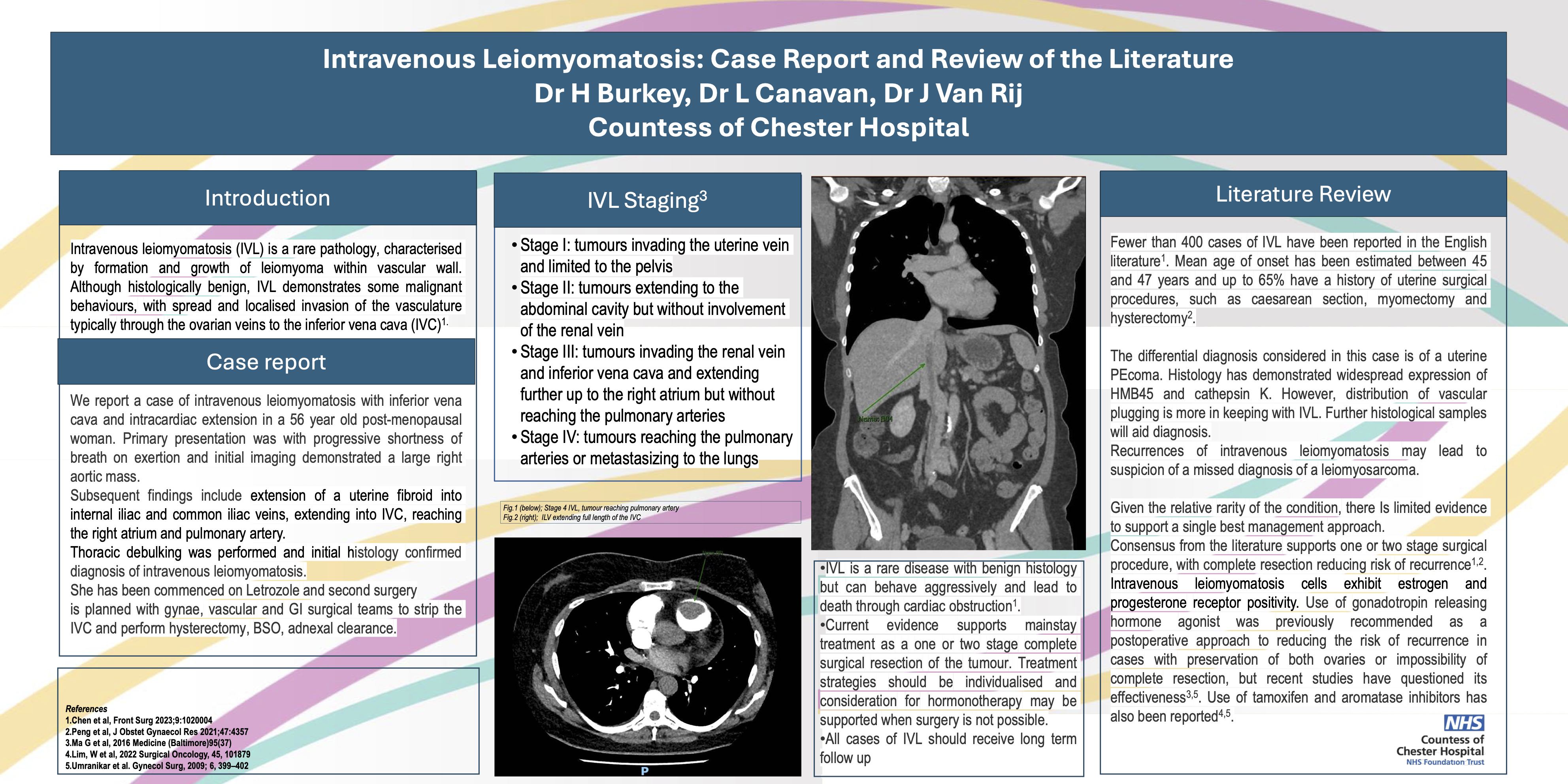 Thumbnail for Intravenous Leiomyomatosis with Intracardiac Extension: A Case Report