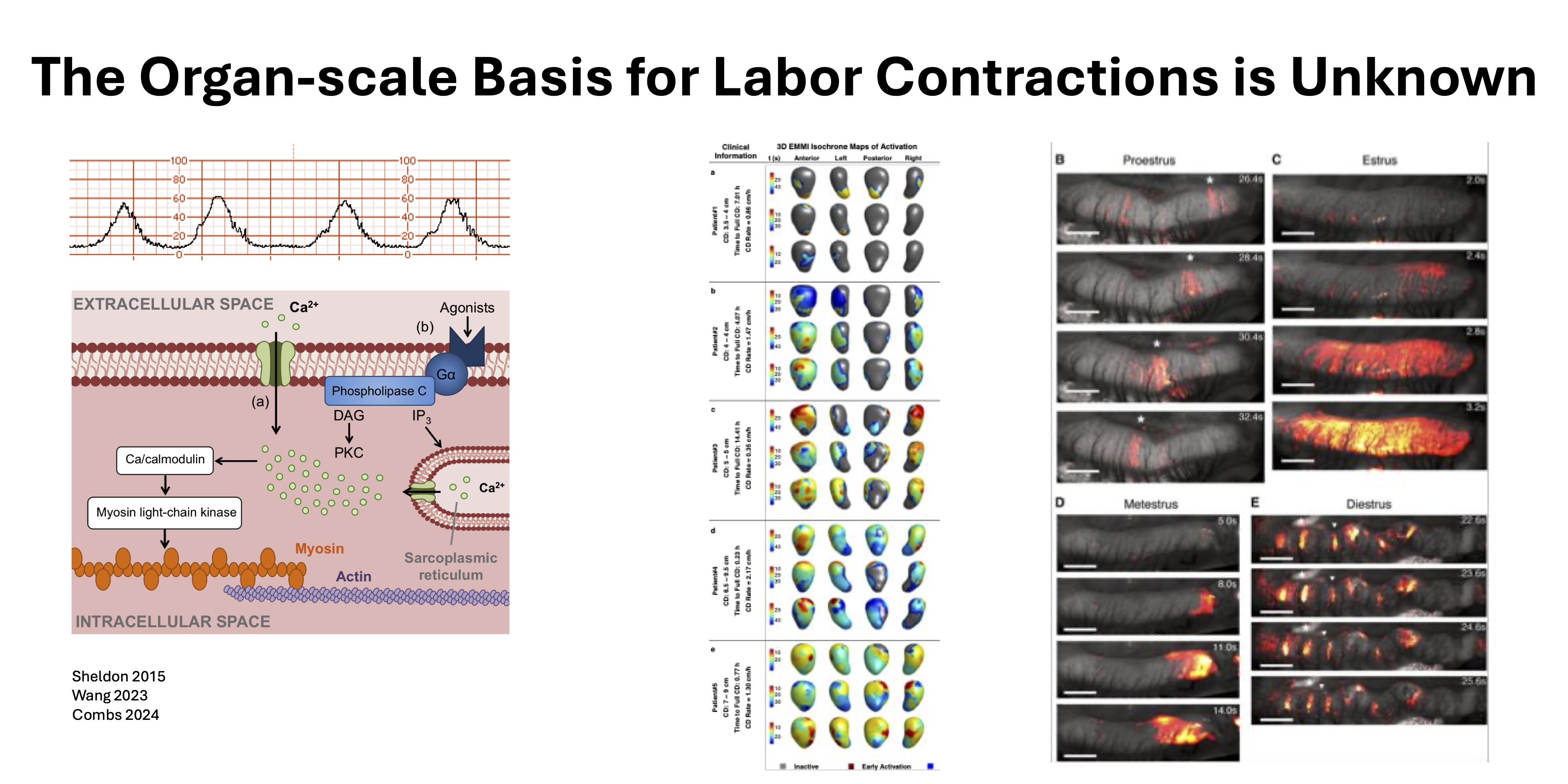 Thumbnail for The Origin Sites for Uterine Contractions in Pregnant Mice. 