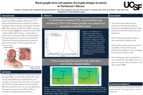 Preview of Basal ganglia beta and gamma electrophysiologic dynamics in Parkinson's Disease