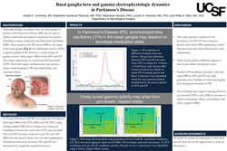 Thumbnail for Basal ganglia beta and gamma electrophysiologic dynamics in Parkinson's Disease