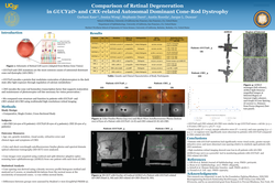 Thumbnail for Comparison of Retinal Degeneration in GUCY2D and CRX-related Autosomal Dominant Cone-Rod Dystrophy