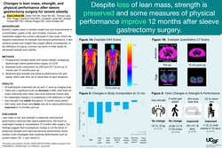 Thumbnail for Changes in lean mass, strength, and physical performance after laparoscopic sleeve gastrectomy surgery for severe obesity