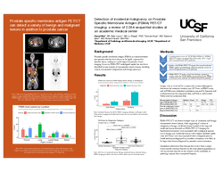Thumbnail for Detection of incidental malignancy on Prostate Specific Membrane Antigen (PSMA) PET/CT imaging: a review of 2,054 sequential studies at an academic medical center
