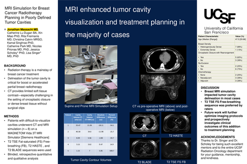 Preview of MRI simulation for breast cancer radiotherapy planning of poorly defined postoperative tumor cavities
