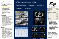 Thumbnail for MRI simulation for breast cancer radiotherapy planning of poorly defined postoperative tumor cavities