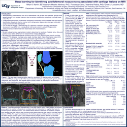 Thumbnail for A More Posterior Tibial Tubercle (Decreased Sagittal Tibial Tubercle-Trochlear Groove Distance) Is Significantly Associated With Patellofemoral Joint Degenerative Cartilage Change: A Deep Learning Analysis