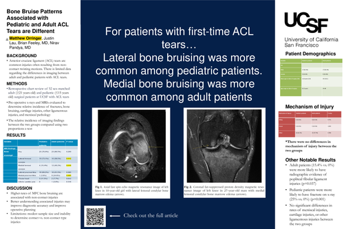 Preview of Bone Bruise Patterns Associated with Pediatric and Adult ACL Tears are Different