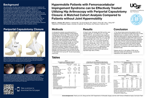 Preview of Hypermobile Patients with Femoroacetabular Impingement Syndrome can be Effectively Treated Utilizing Hip Arthroscopy with Periportal Capsulotomy Closure: A Matched Cohort Analysis Compared to Patients without Joint Hypermobility