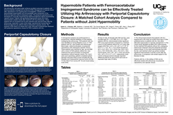 Thumbnail for Hypermobile Patients with Femoroacetabular Impingement Syndrome can be Effectively Treated Utilizing Hip Arthroscopy with Periportal Capsulotomy Closure: A Matched Cohort Analysis Compared to Patients without Joint Hypermobility