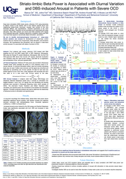 Thumbnail for Striato-limbic Beta Power is Associated with Diurnal Variation and DBS-induced Arousal in Patients with Severe OCD