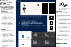 Thumbnail for Deep-Learning Algorithms for PSMA-PET Image Segmentation: The Effect of Grouping Data